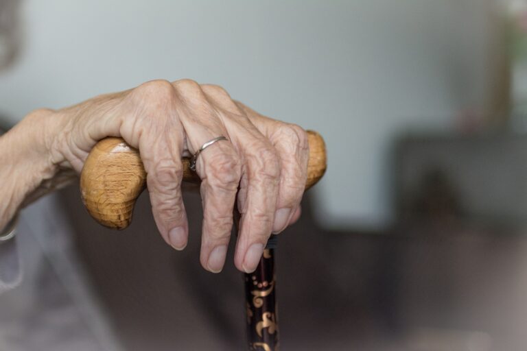 elderly white hand holding top of cane